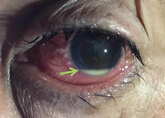 Creative Commons images