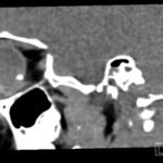 Creative Commons images