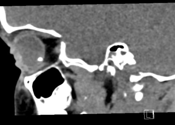 Creative Commons images