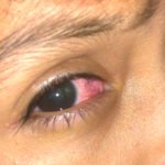 Creative Commons images