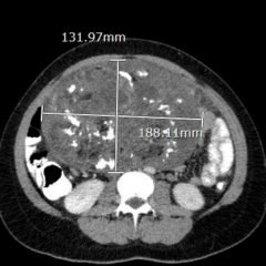 Creative Commons images