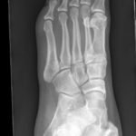 Creative Commons images