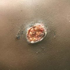 Creative Commons images