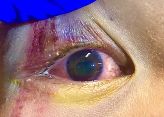 Creative Commons images