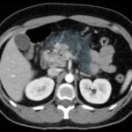 Creative Commons images