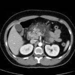 Creative Commons images