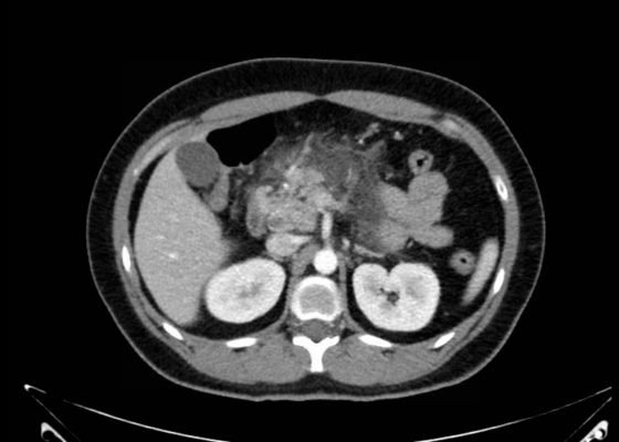 Creative Commons images