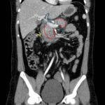 Creative Commons images