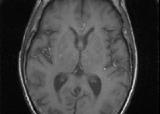 Creative Commons images