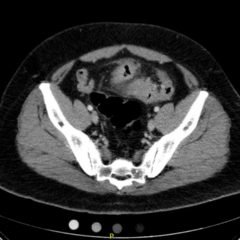 Creative Commons images