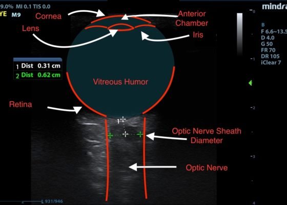 Creative Commons images
