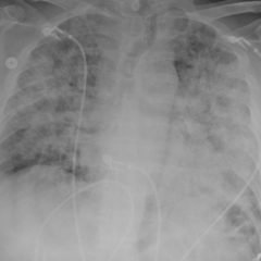 Creative Commons images