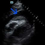 Creative Commons images