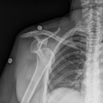 Creative Commons images