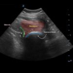 Creative Commons images