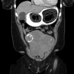 Creative Commons images