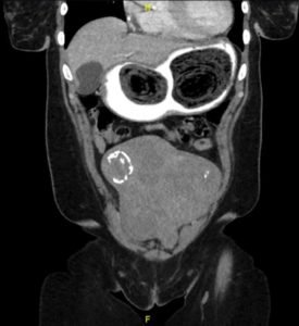 Creative Commons images