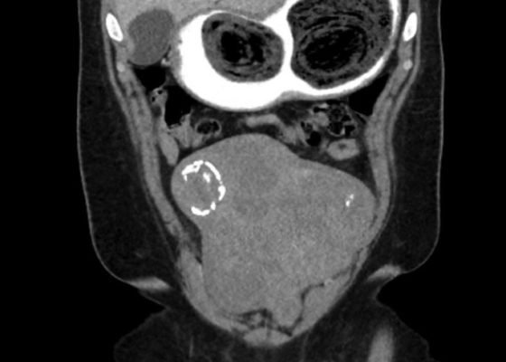 Creative Commons images