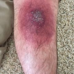 Creative Commons images