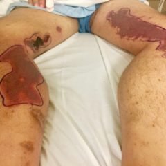 Creative Commons images