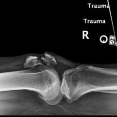 Creative Commons images