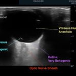 Creative Commons images