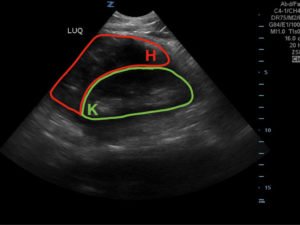 Creative Commons images