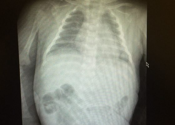 Creative Commons images