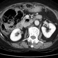 Creative Commons images