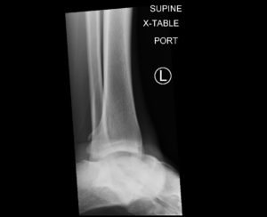 Creative Commons images