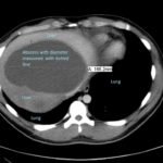 Creative Commons images