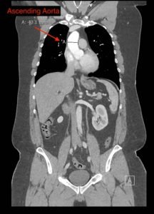 Creative Commons images