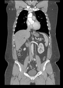 Creative Commons images