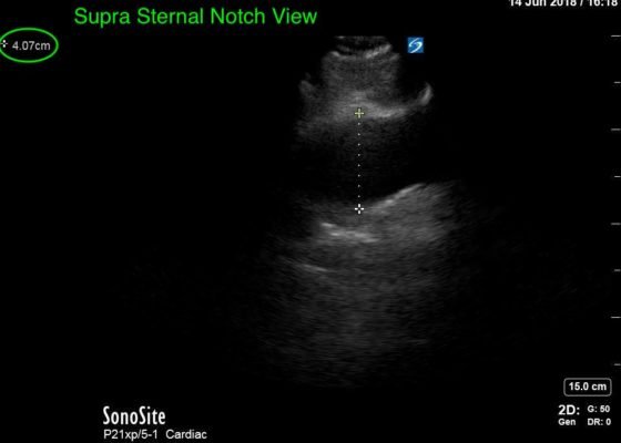 Creative Commons images