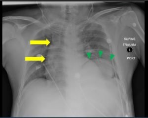 Creative Commons images