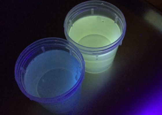 Case Report: Antifreeze Ingestion and Urine Fluorescence 14 Creative Commons images