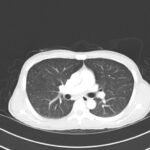 Creative Commons images