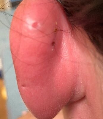 Creative Commons images