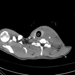 Creative Commons images