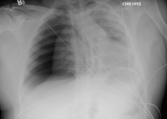 Creative Commons images