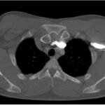 Creative Commons images