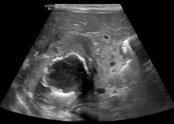 Creative Commons images