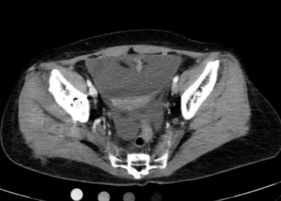 Creative Commons images