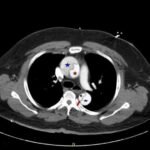 Creative Commons images