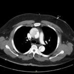 Creative Commons images