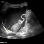 Creative Commons images