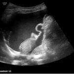 Creative Commons images