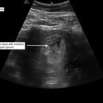 Creative Commons images