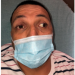 Case Report of a Man with Right Eye Pain and Double Vision 1 Creative Commons images