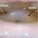 Creative Commons images